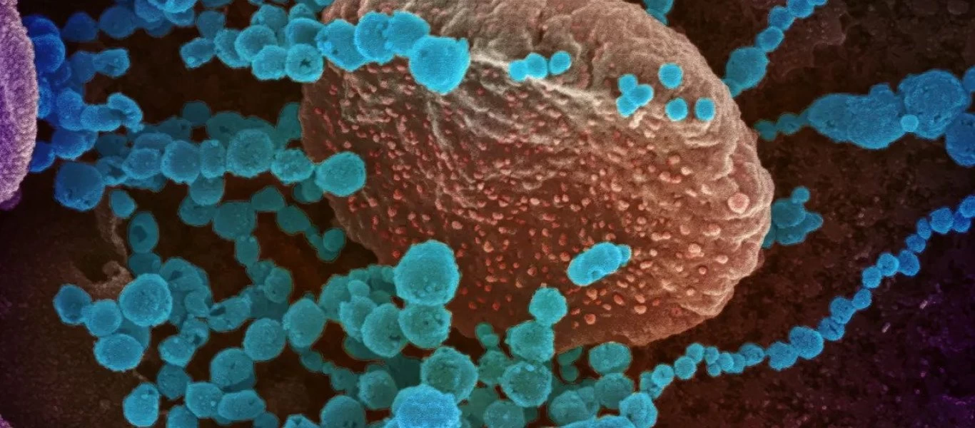 ΗΠΑ: Ερευνητές του ΜΙΤ αναγνώρισαν το είδος κυττάρων που στοχεύει ο κορωνοϊός στο ανθρώπινο σώμα